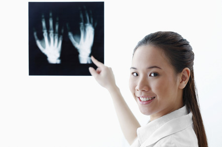 Female doctor pointing at hand x-rayの写真素材