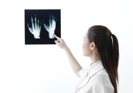 Female doctor pointing at hand x-ray
