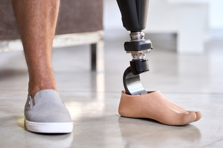 Amputee man with above knee leg prosthesis standing on feet, close up.の写真素材