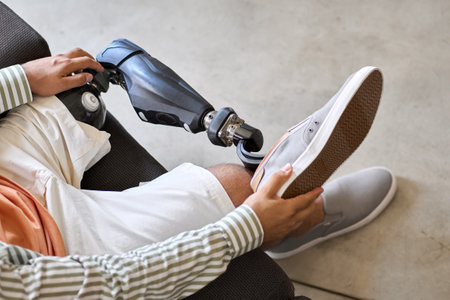 Amputee man with above knee leg prosthesis sitting on sofa wearing shoe.の写真素材