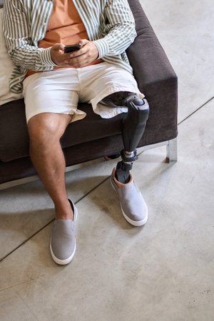 Amputee man with leg prosthesis sitting on sofa at home using phone.