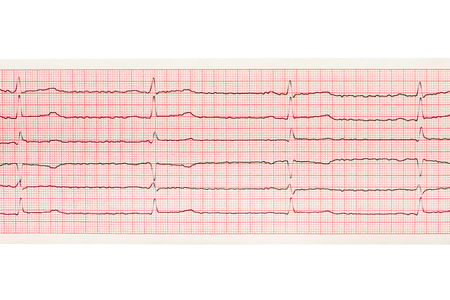 Paper ECG results isolated on white background. Clipping path included.の写真素材