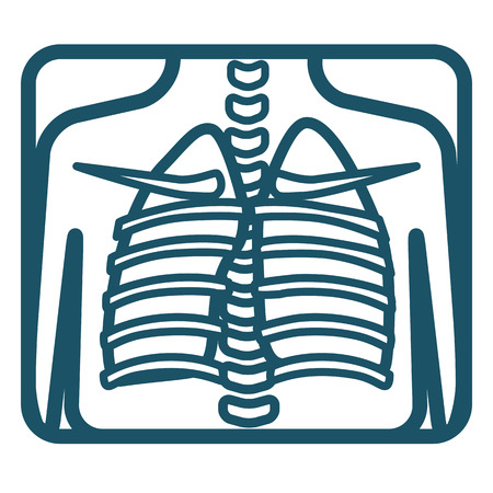 Human lungs xray image. Vector illustration.の写真素材