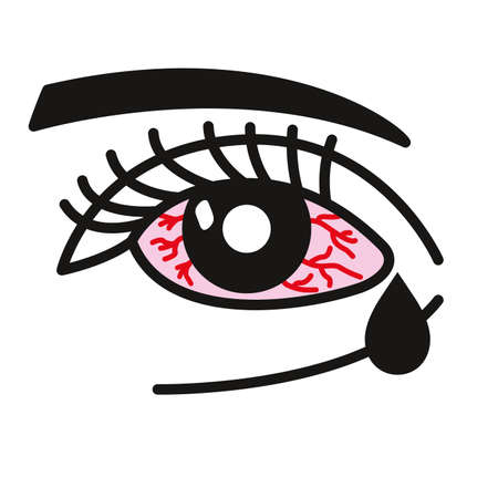 Inflammated eye Conjunctivitis or pink eyeのイラスト素材