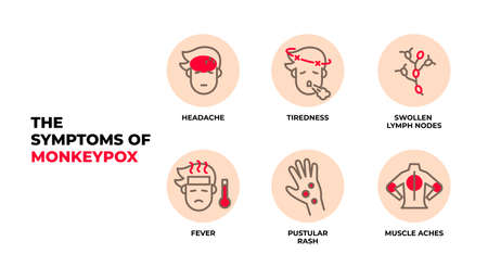 The symptoms of Monkeypox virus infographic vector.のイラスト素材