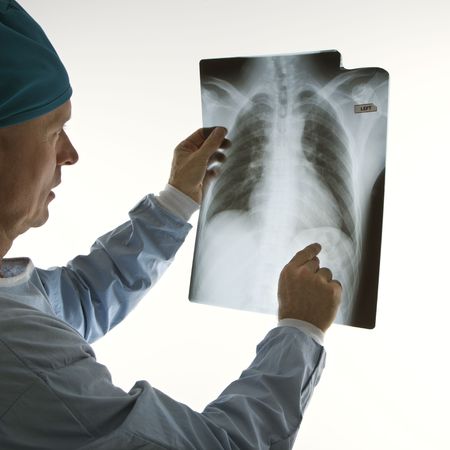 Mid-adult Caucasian male doctor pointing at an x-ray.の写真素材