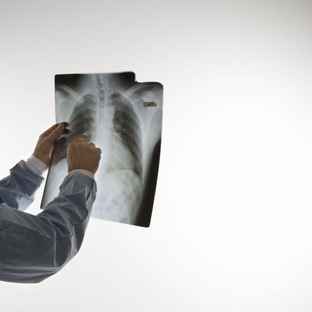 Mid-adult Caucasian male doctor pointing at an x-ray.の写真素材