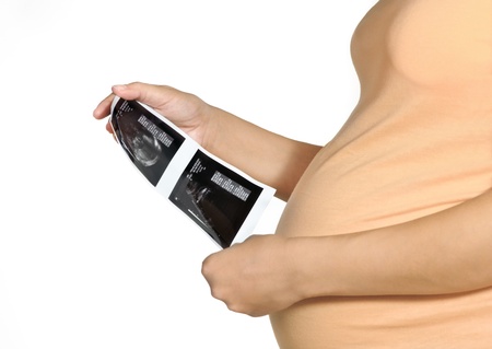 Pregnant woman is watching on ultrasound 