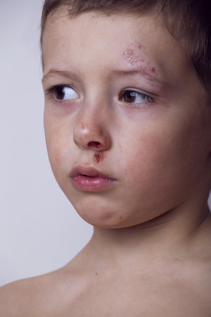 Little boy whipped close up, isolatedの写真素材