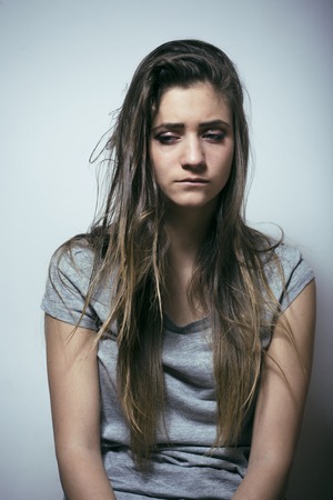 problem depressioned sad teenage with messed hair and sad face, real junky close upの写真素材