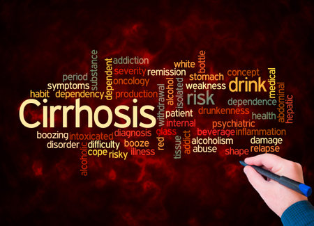 Word Cloud with CIRRHOSIS concept create with text only.の写真素材