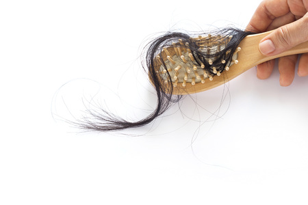 woman losing hair on hairbrush in handの写真素材
