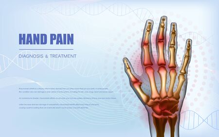 Osteoarthritis rheumatoid arthritis hand sore joints conceptのイラスト素材