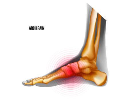 Arch of foot pain bones skeleton realistic anatomy illustrationのイラスト素材