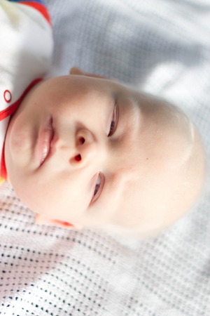Whitehair babyboy with albinism syndromeの写真素材