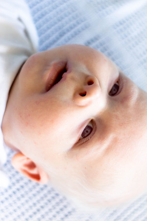 Whitehair babyboy with albinism syndromeの写真素材