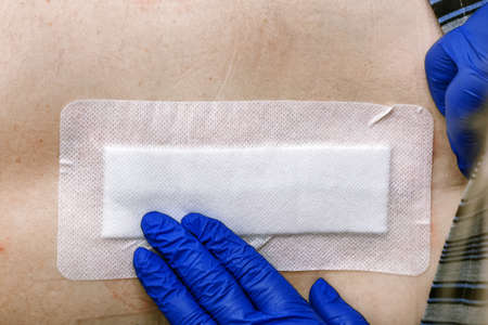 The nurse's hands are patching the postoperative seam with a plaster. Standard hospital dressing.の写真素材