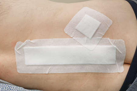 Postoperative suture sealed with a plaster after spinal surgeryの写真素材