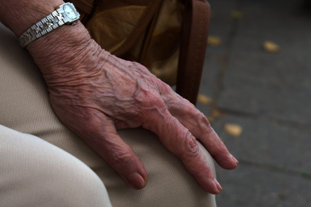 elderly woman hand with a watch on her knee