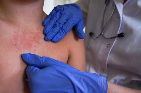 The physician is inspecting the child's skin for signs of monkeypox.