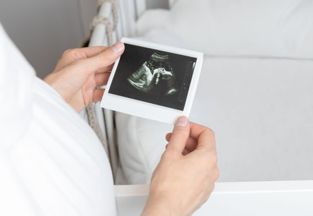 pregnant woman holds ultrasound photo of baby above crib