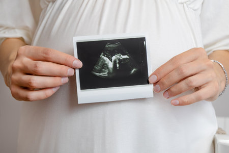 pregnant woman in white nightgown holding baby photo from ultrasoundの写真素材