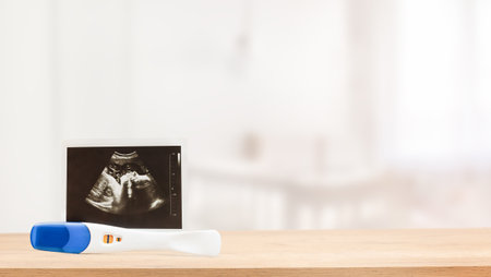 ultrasound picture of baby and pregnancy test against the background of a child's roomの写真素材