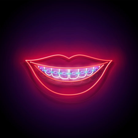Glow Beautiful Smile with Braces and Red Lips. Orthodontic Clinic Concept Template. Neon Light Poster, Flyer, Banner, Signboard. Glossy Background. Vector 3d Illustrationのイラスト素材