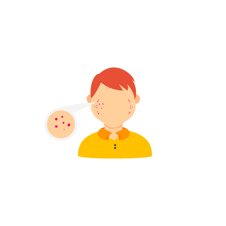Acne infographics. Illustration of a sick man. Information about the diseaseのイラスト素材