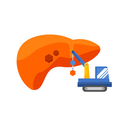 liver infographic vector illustration. Treatment regeneration decay drug. Regeneration of the liverのイラスト素材