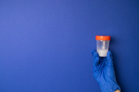 Doctors hand in latex blue gloves holds a plastic container with biological material. Medical...