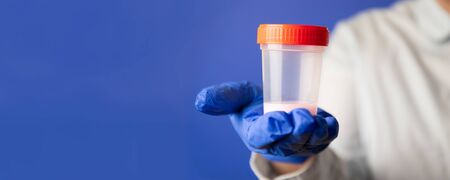 Semen analysis. Sperm bank concept. Infertility. Doctors Hand Container for analysis. Health and Conceptionの写真素材