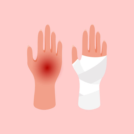 Injured hand of the girl tied up by white bandage. Broken, cut, injured hand. First aid for bruises, trauma or cutsのイラスト素材