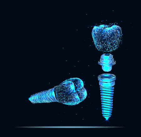 Tooth human implant. Dental conceptのイラスト素材
