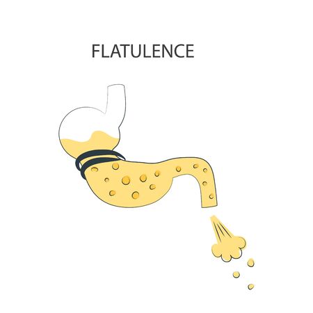 Medical banner for flatulence. Formation of gases in the stomach. Pancreatitis. Diseases of the stomach and colon. Vector illustrationのイラスト素材
