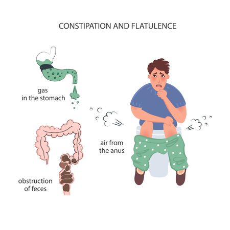 Constipation and flatulence in men. Air outlet through the anus. Gas in the stomach and fecal obstruction in the intestines. The vector of bloatingのイラスト素材