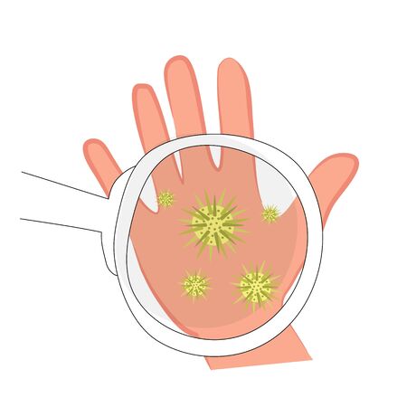 Huge bacteria and micro-organisms in the palm of your hand under a magnifying glass. Skin diseases and infection through dirty hands. Vector illustrationのイラスト素材