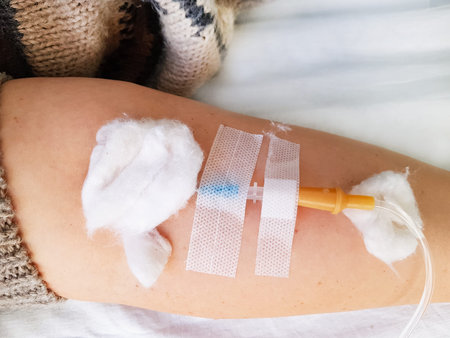 A woman is given an intravenous dropper in her hand. Closeup soft focus. Intravenous injection during resuscitation in a hospital. Treatment in extreme conditions of an infectious pandemic. Coronavirus covid-19.の写真素材