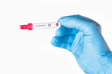 Test tube with a positive test for coronavirus infection Covid 19 in the doctor's hand. Coronavirus testing. A hand in an individual disposable protective glove holds a test tube with a coronovirus test.の写真素材