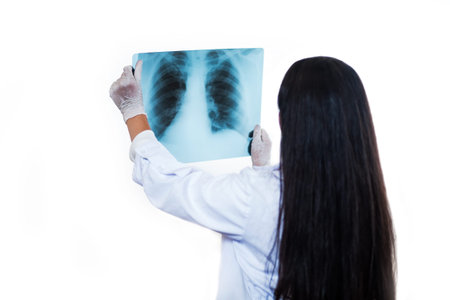 X-ray of the chest in the hands of a doctor. a doctor with long dark hair in a white coat and...