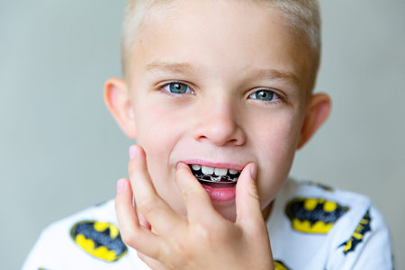 The boy inserts an orthodontic plate in his mouth.