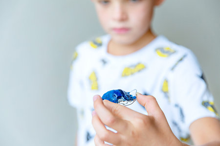 A boy shows a blue children's orthodontic plate. The boy is out of focus