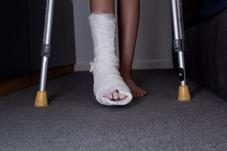 Teenager boy with injured broken leg in a plaster cast on the bed at home with crutches.の写真素材