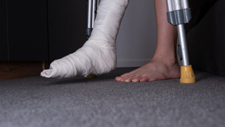 Teenager boy with injured broken leg in a plaster cast on the bed at home with crutches.の写真素材