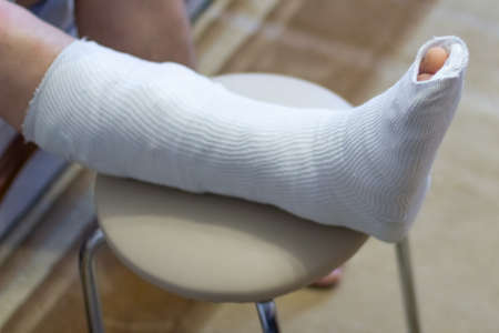The guy is sitting on the couch in a cast. The leg is in a cast.の写真素材