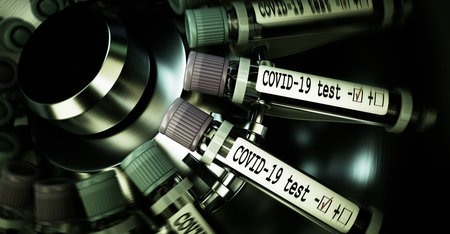Tube of biological sample contaminated by Coronavirus with label Covid-19. Vials of blood in a...