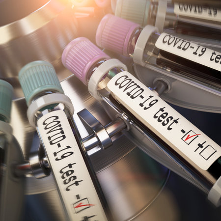 Negative COVID-19 test and laboratory sample of blood testing for diagnosis new Corona virus...