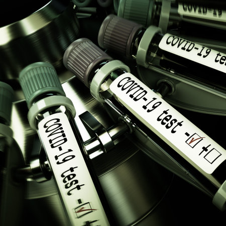 Tube of biological sample contaminated by Coronavirus with label Covid-19. Vials of blood in a...