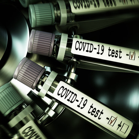Tube of biological sample contaminated by Coronavirus with label Covid-19. Vials of blood in a...