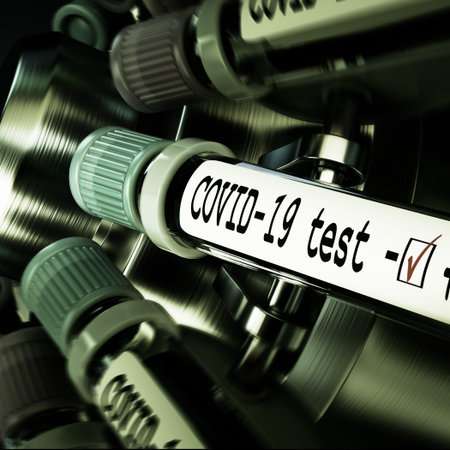 Tube of biological sample contaminated by Coronavirus with label Covid-19. Vials of blood in a...